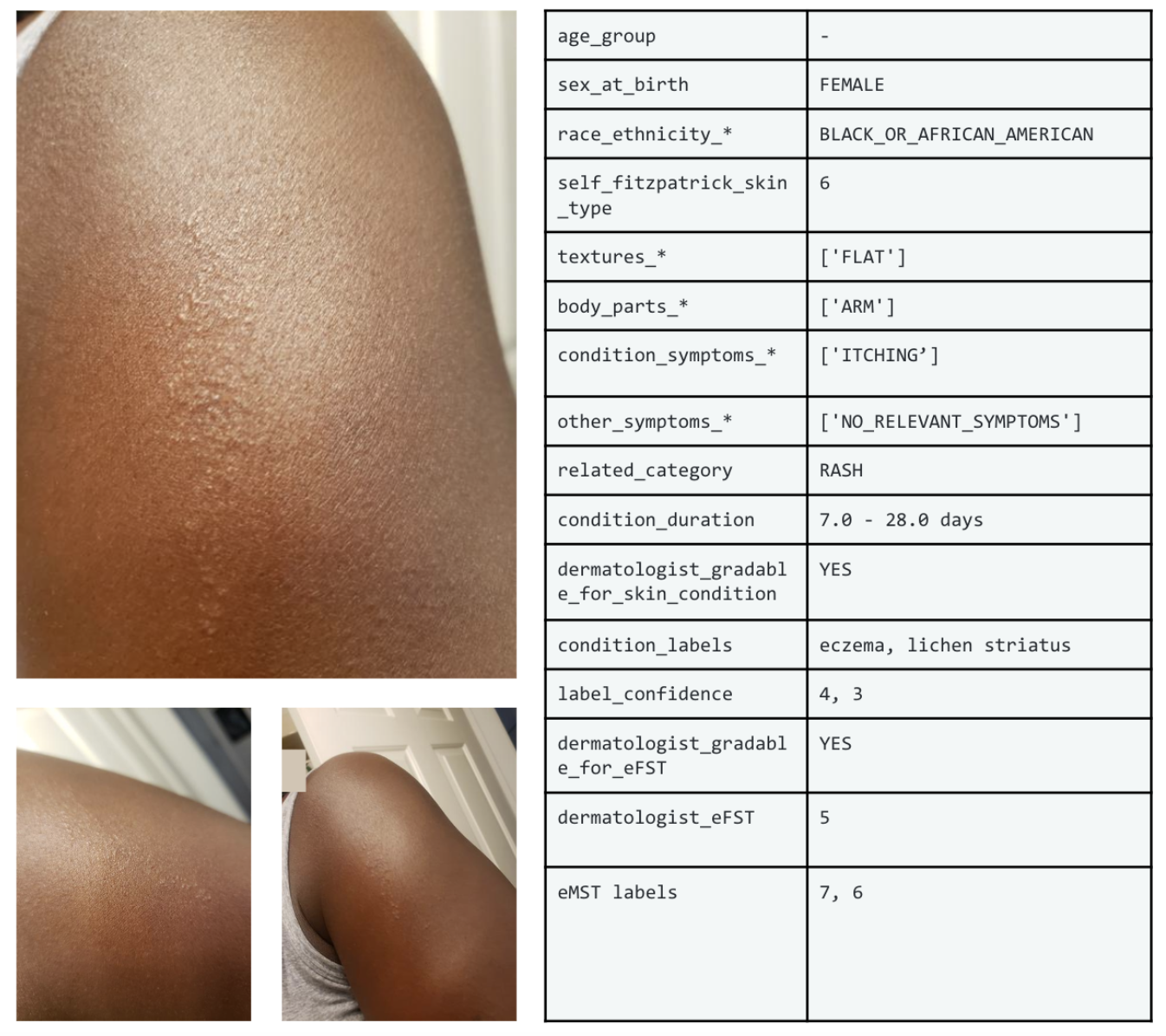 Google launches SCIN dataset for training AI on common skin diseases