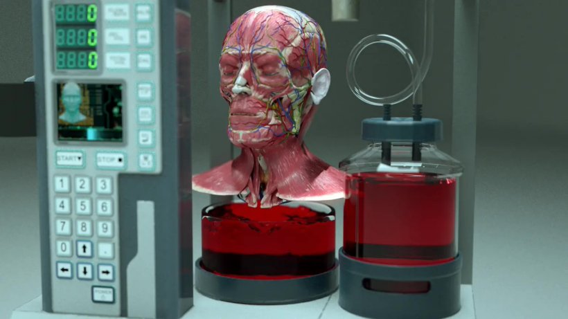 9abbb83c-ae9e-4b84-9e35-c2c786c5e9af.jpg@s_2w_820h_461 Startup BrainBridge proposes the world's first "human head transplant machine" concept, with the goal of launching it within 8 years