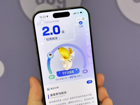 拍照可测脱发等级 支付宝上线AI毛发自测工具