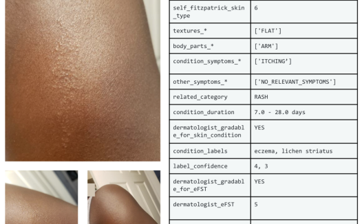 可用于训练“常见皮肤疾病”AI,谷歌推出 SCIN 数据集