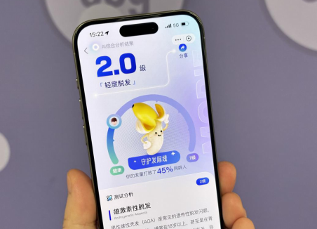 拍照可测脱发等级 支付宝上线AI毛发自测工具