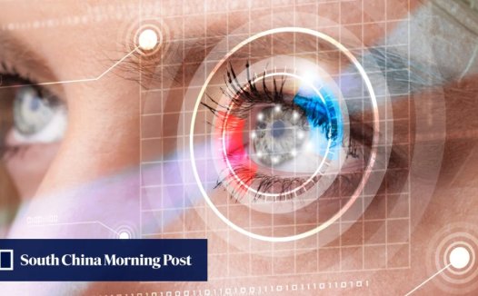 香港中文大学开发新型基础 AI 模型,多种眼科疾病诊断能力优于人类医生