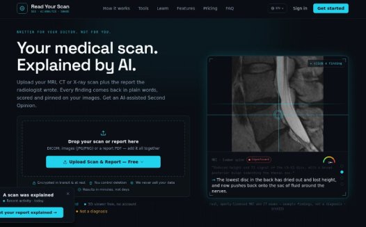 Read Your Scan:在浏览器中查看3D医学影像,获取AI生成的通俗解读与严重程度评分